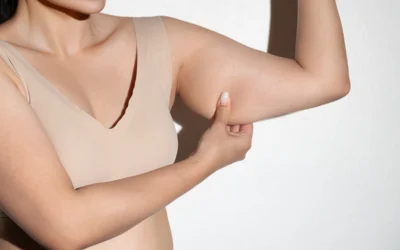 Can an Arm Lift Get Rid of ‘Bat Wings’?