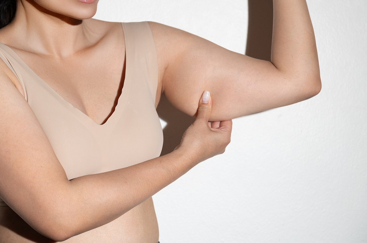 a woman pinches her upper arm to examine body fat a woman pinches her upper arm to examine body fat