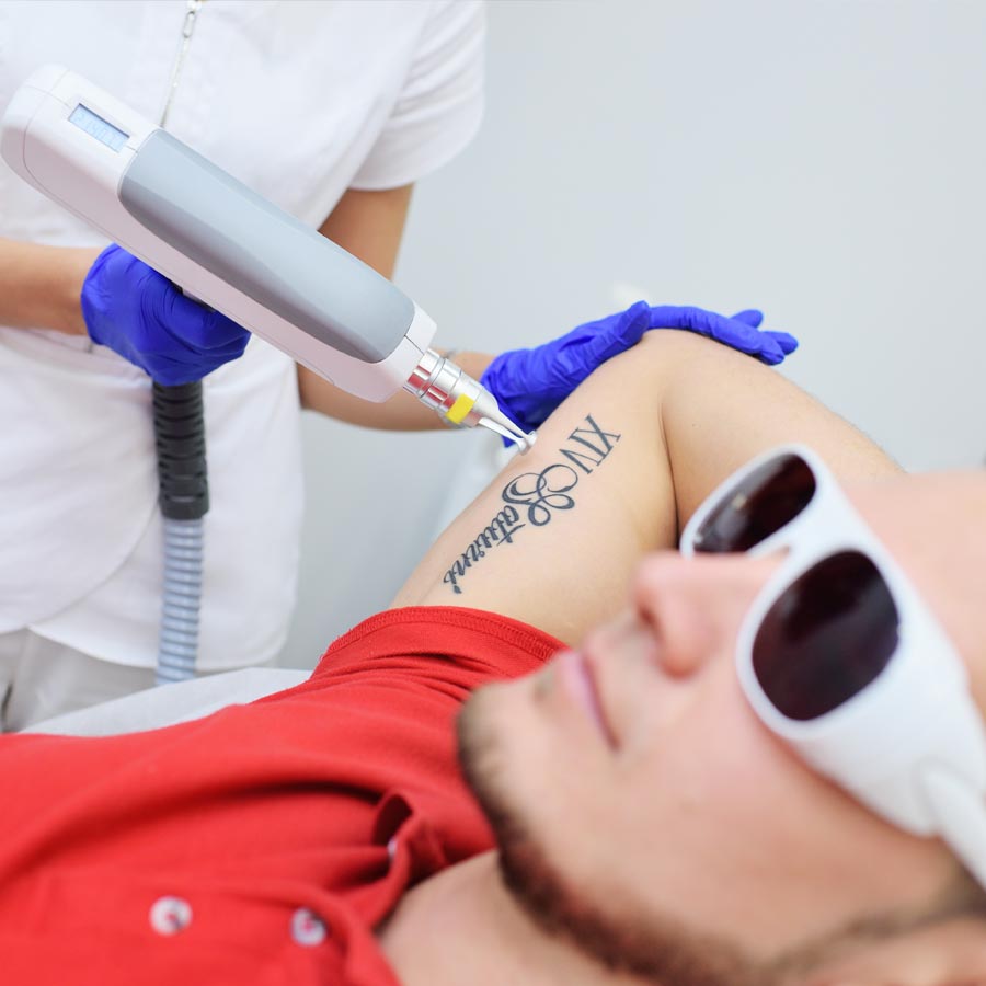 tattoo removal neodymium laser in the beauty salon . Laser cosmetology