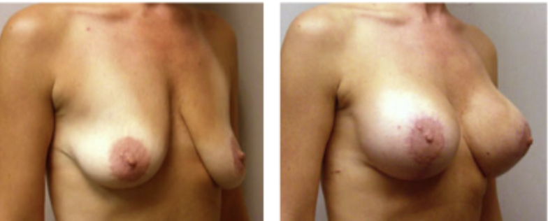 Screenshot at .. PM