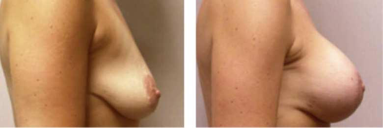 Screenshot at .. PM