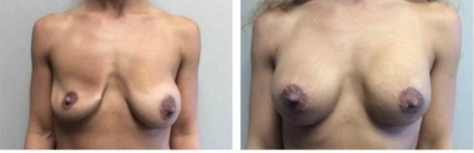 Screenshot at .. PM