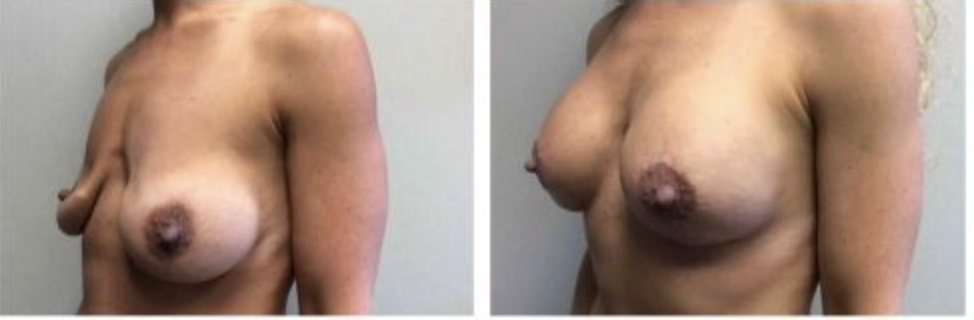 Screenshot at .. PM